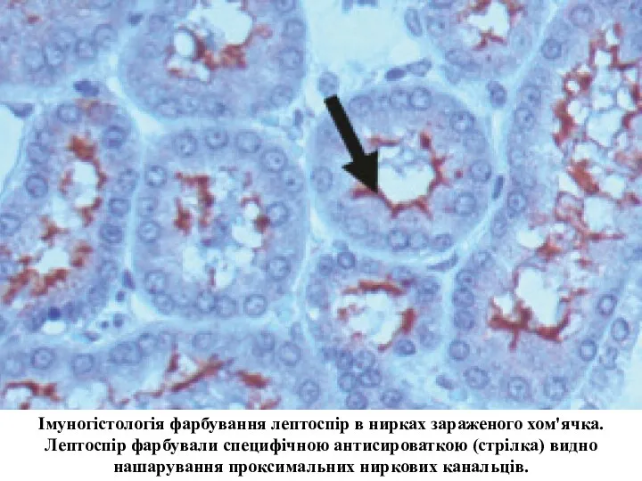 Імуногістологія фарбування лептоспір в нирках зараженого хом'ячка. Лептоспір фарбували специфічною
