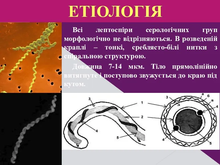 Всі лептоспіри серологічних груп морфологічно не відрізняються. В розведеній краплі