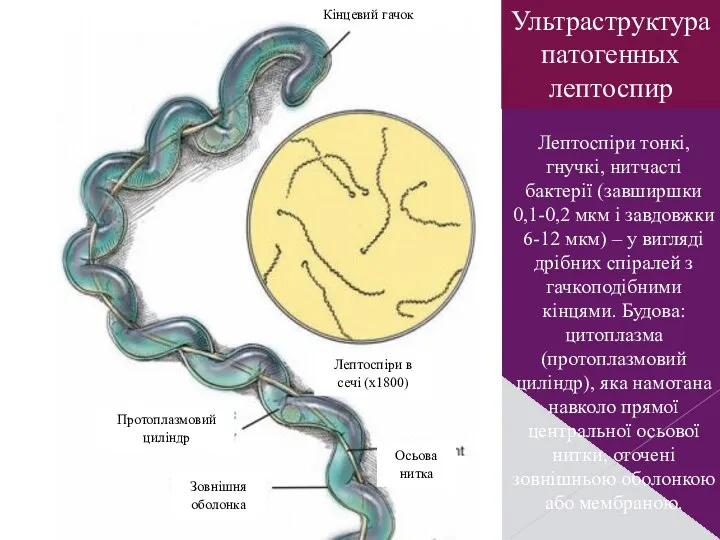 Ультраструктура патогенных лептоспир Лептоспіри тонкі, гнучкі, нитчасті бактерії (завширшки 0,1-0,2