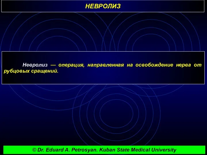 НЕВРОЛИЗ Невролиз — операция, направленная на освобождение нерва от рубцовых сращений. © Dr.