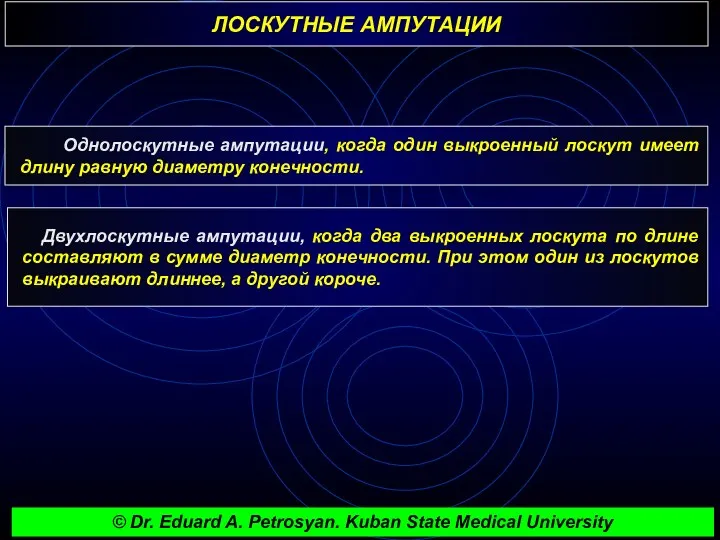 ЛОСКУТНЫЕ АМПУТАЦИИ Однолоскутные ампутации, когда один выкроенный лоскут имеет длину равную диаметру конечности.