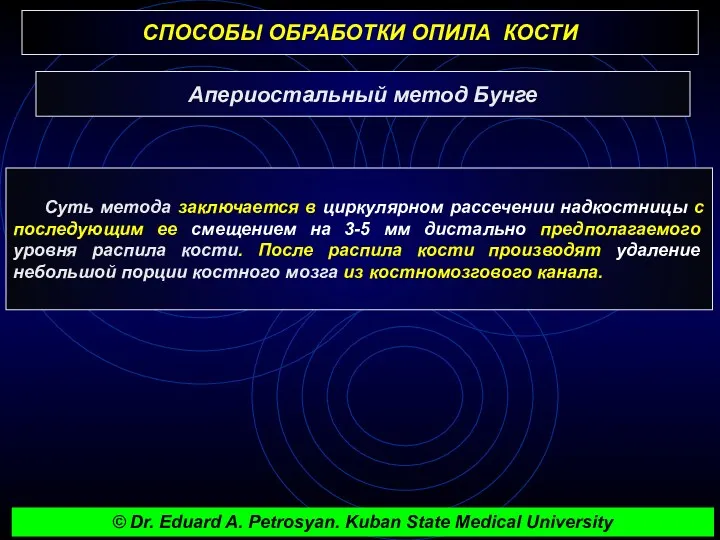 СПОСОБЫ ОБРАБОТКИ ОПИЛА КОСТИ Суть метода заключается в циркулярном рассечении надкостницы с последующим