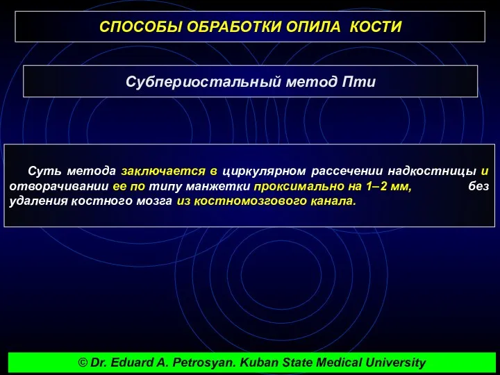 СПОСОБЫ ОБРАБОТКИ ОПИЛА КОСТИ Субпериостальный метод Пти Суть метода заключается в циркулярном рассечении