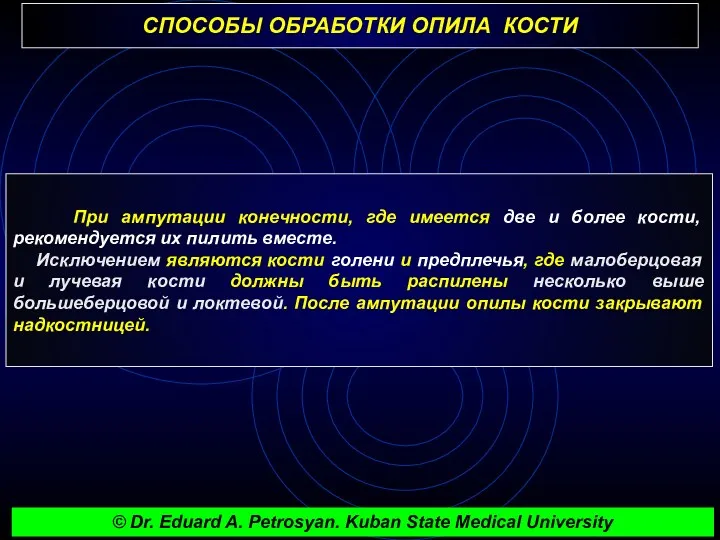 СПОСОБЫ ОБРАБОТКИ ОПИЛА КОСТИ При ампутации конечности, где имеется две и более кости,