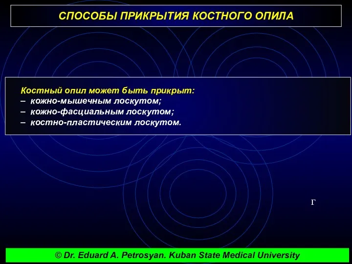 СПОСОБЫ ПРИКРЫТИЯ КОСТНОГО ОПИЛА г Костный опил может быть прикрыт: – кожно-мышечным лоскутом;