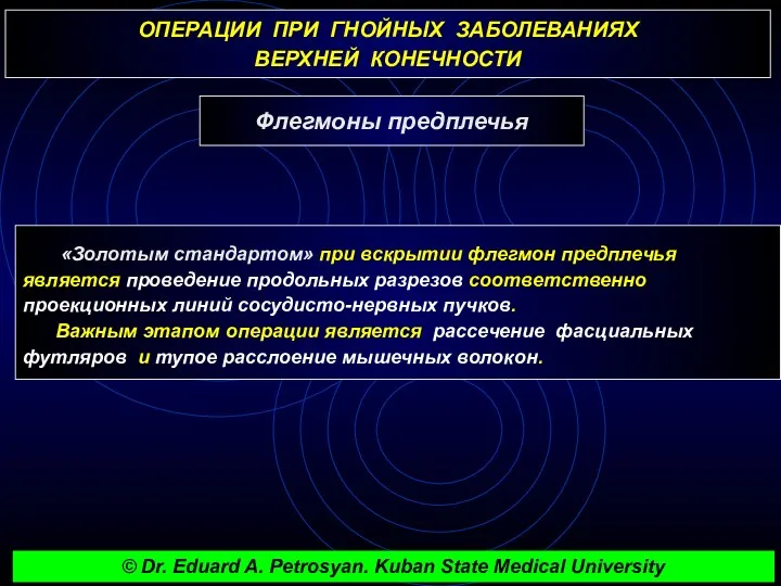 ОПЕРАЦИИ ПРИ ГНОЙНЫХ ЗАБОЛЕВАНИЯХ ВЕРХНЕЙ КОНЕЧНОСТИ Флегмоны предплечья «Золотым стандартом» при вскрытии флегмон