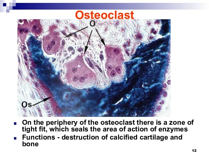 Osteoclast On the periphery of the osteoclast there is a