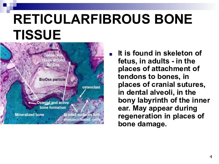RETICULARFIBROUS BONE TISSUE It is found in skeleton of fetus,