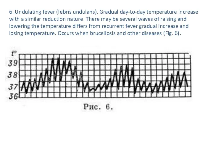 6. Undulating fever (febris undulans). Gradual day-to-day temperature increase with a similar reduction