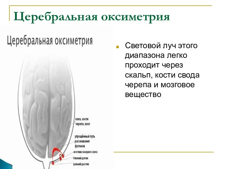 Церебральная оксиметрия Световой луч этого диапазона легко проходит через скальп, кости свода черепа и мозговое вещество