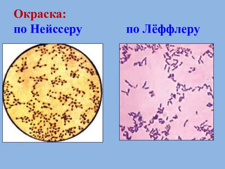 Окраска: по Нейссеру по Лёффлеру