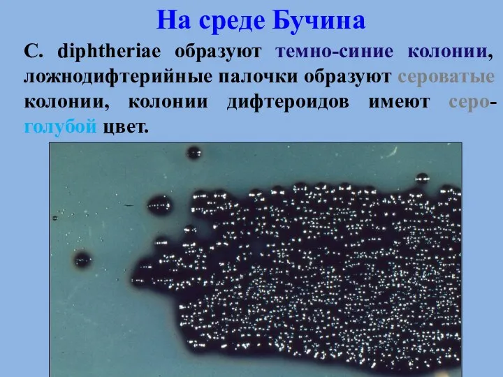 На среде Бучина C. diphtheriae образуют темно-синие колонии, ложнодифтерийные палочки