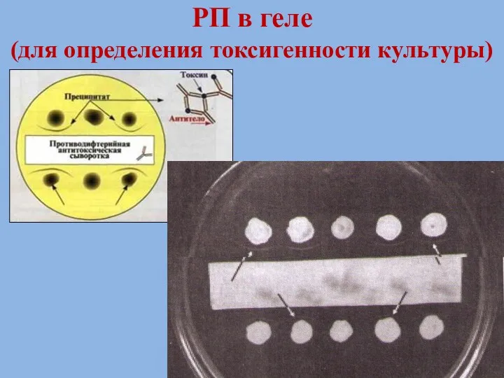 РП в геле (для определения токсигенности культуры)