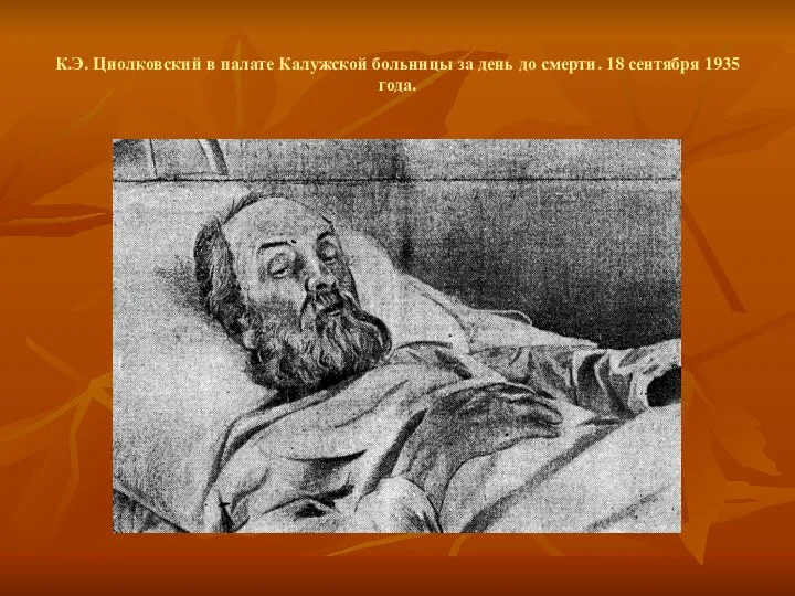 К.Э. Циолковский в палате Калужской больницы за день до смерти. 18 сентября 1935 года.