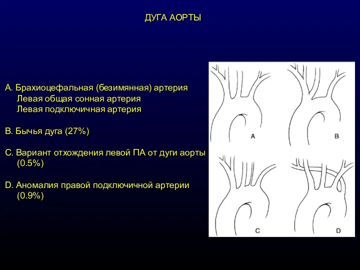 А. Брахиоцефальная (безимянная) артерия Левая общая сонная артерия Левая подключичная