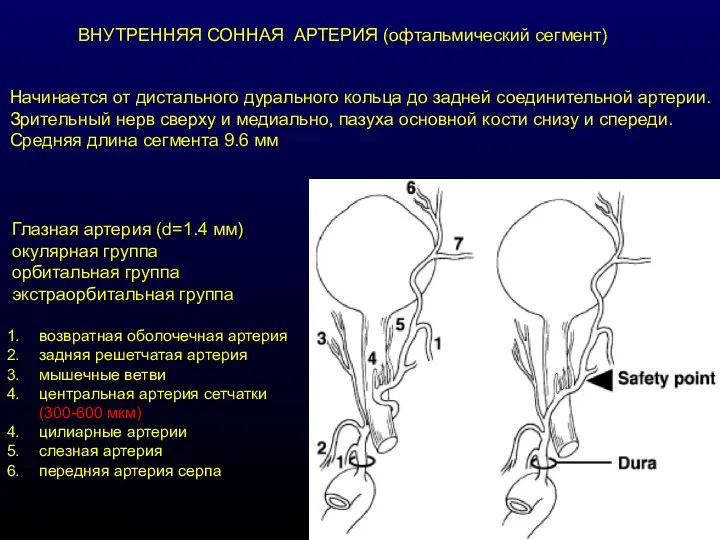 ВНУТРЕННЯЯ СОННАЯ АРТЕРИЯ (офтальмический сегмент) Начинается от дистального дурального кольца