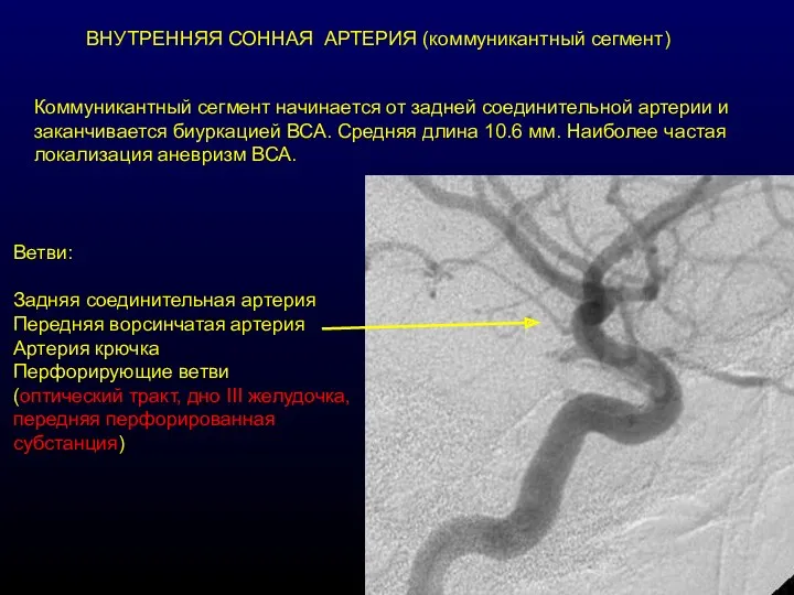 ВНУТРЕННЯЯ СОННАЯ АРТЕРИЯ (коммуникантный сегмент) Коммуникантный сегмент начинается от задней