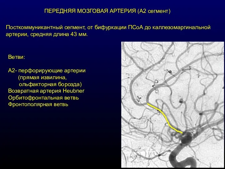 ПЕРЕДНЯЯ МОЗГОВАЯ АРТЕРИЯ (А2 сегмент) Посткоммуникантный сегмент, от бифуркации ПСоА