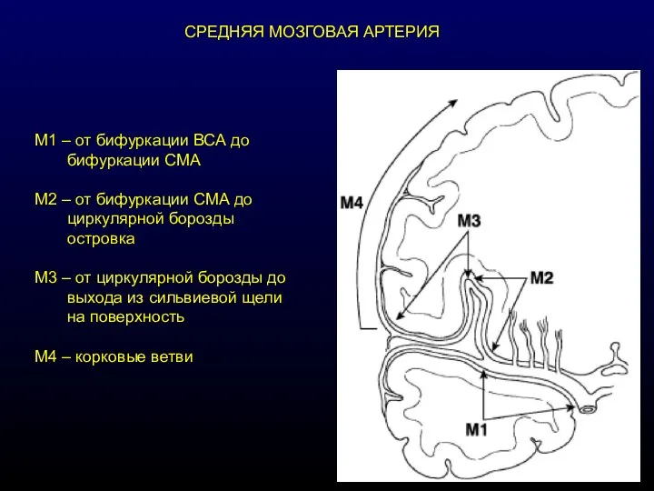 СРЕДНЯЯ МОЗГОВАЯ АРТЕРИЯ М1 – от бифуркации ВСА до бифуркации