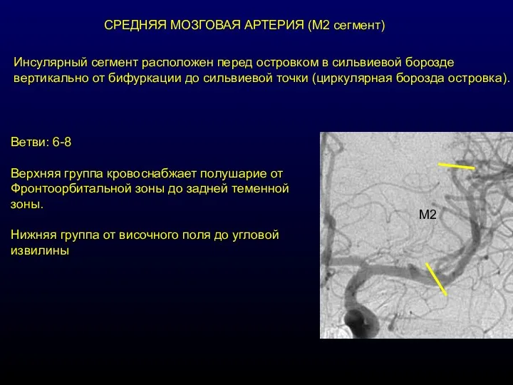 СРЕДНЯЯ МОЗГОВАЯ АРТЕРИЯ (М2 сегмент) Инсулярный сегмент расположен перед островком