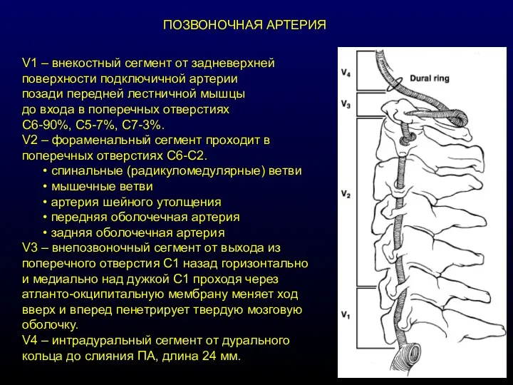 ПОЗВОНОЧНАЯ АРТЕРИЯ V1 – внекостный сегмент от задневерхней поверхности подключичной