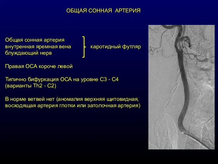 Общая сонная артерия внутренная яремная вена каротидный футляр блуждающий нерв