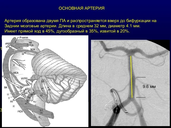 ОСНОВНАЯ АРТЕРИЯ Артерия образована двумя ПА и распространяется вверх до