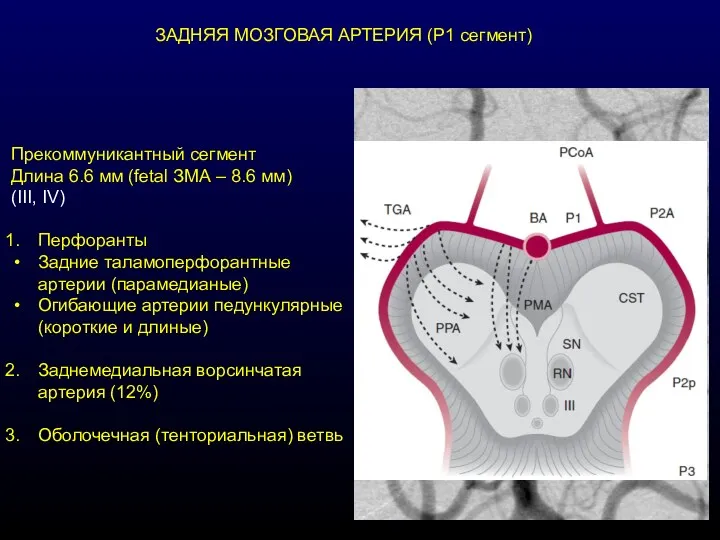 ЗАДНЯЯ МОЗГОВАЯ АРТЕРИЯ (Р1 сегмент) Прекоммуникантный сегмент Длина 6.6 мм