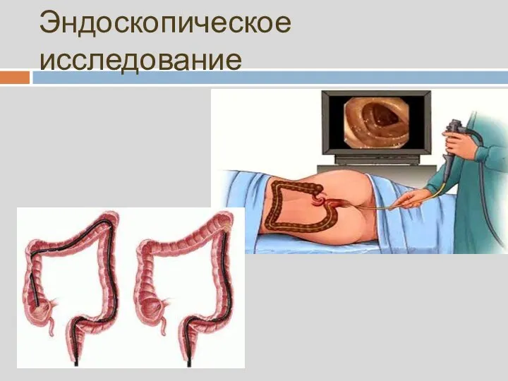 Эндоскопическое исследование