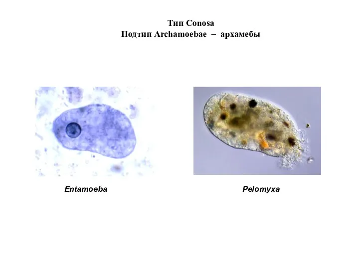 Тип Conosa Подтип Archamoebae – архамебы Entamoeba Pelomyxa