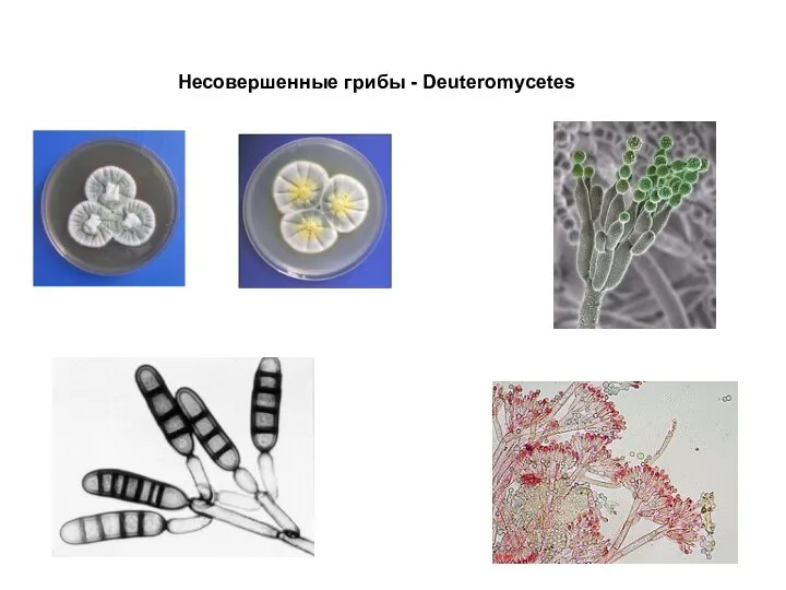 Несовершенные грибы - Deuteromycetes