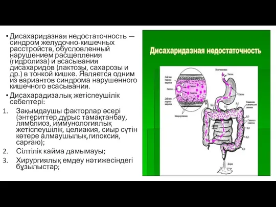 Дисахаридазная недостаточность — синдром желудочно-кишечных расстройств, обусловленный нарушением расщепления (гидролиза)