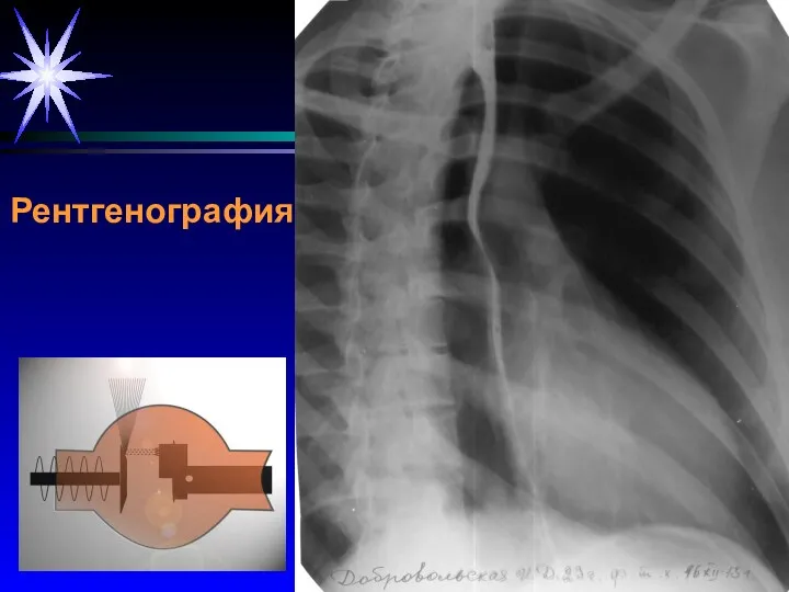 Рентгенография