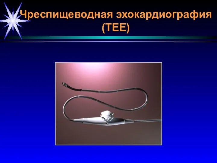 Чреспищеводная эхокардиография (TEE)