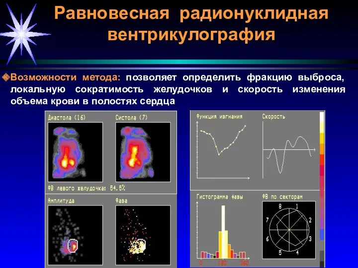 Равновесная радионуклидная вентрикулография Возможности метода: позволяет определить фракцию выброса, локальную сократимость желудочков и