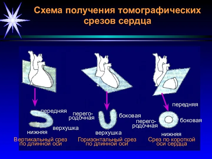 Схема получения томографических срезов сердца