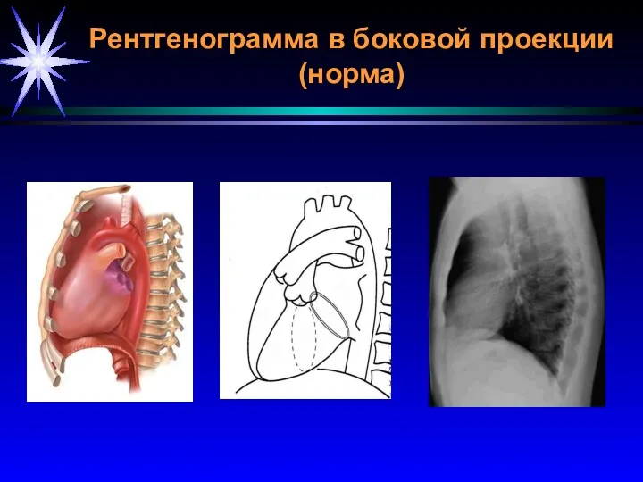 Рентгенограмма в боковой проекции (норма)