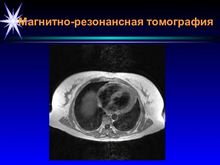 Магнитно-резонансная томография