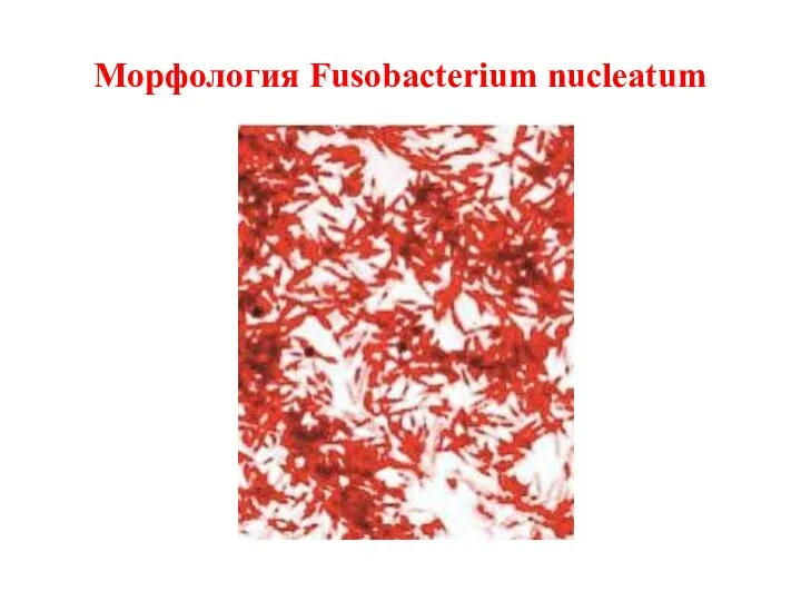 Морфология Fusobacterium nucleatum