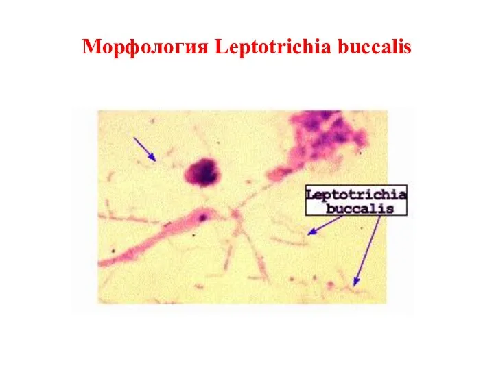 Морфология Leptotrichia buccalis