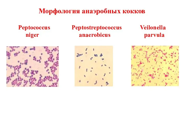 Морфология анаэробных кокков Peptococcus Peptostreptococcus Veilonella niger anaerobicus parvula