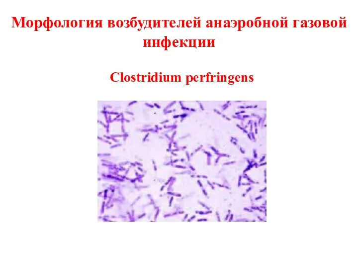 Морфология возбудителей анаэробной газовой инфекции Clostridium perfringens