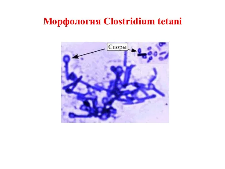 Морфология Clostridium tetani