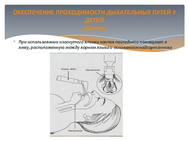 При использовании изогнутого клинка кончик последнего помещают в ямку, расположенную