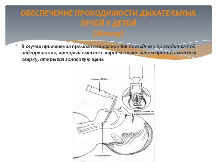 В случае применения прямого клинка кончик последнего проводится под надгортанник,