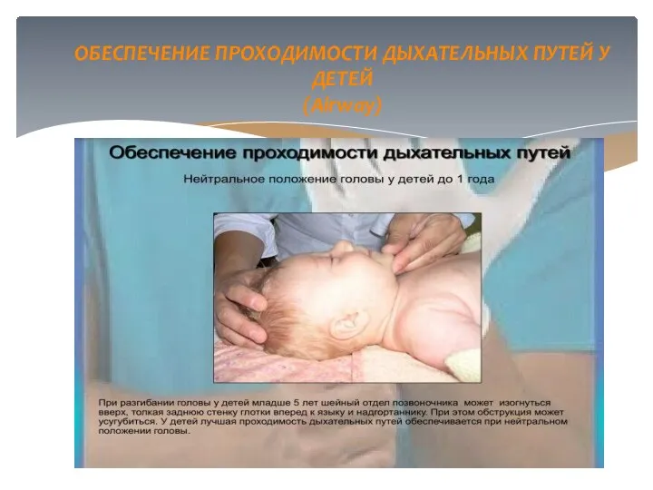 ОБЕСПЕЧЕНИЕ ПРОХОДИМОСТИ ДЫХАТЕЛЬНЫХ ПУТЕЙ У ДЕТЕЙ (Airway)