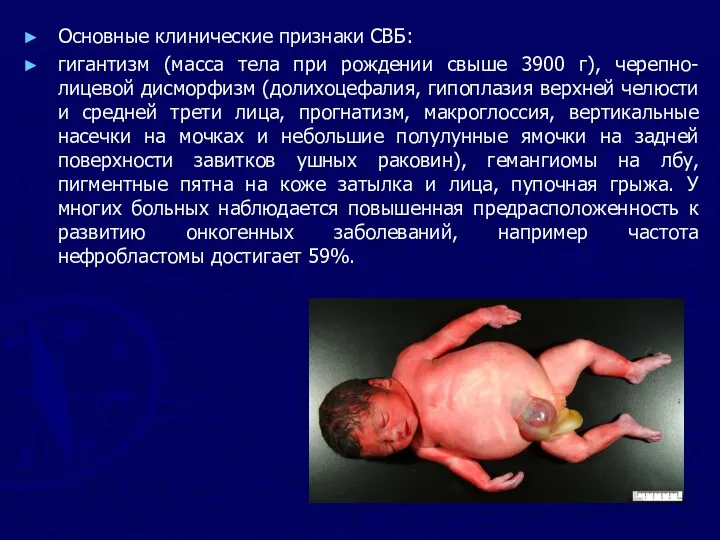 Основные клинические признаки СВБ: гигантизм (масса тела при рождении свыше 3900 г), черепно-лицевой