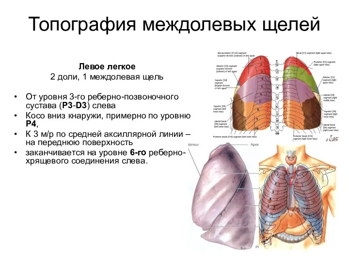 Топография междолевых щелей Левое легкое 2 доли, 1 междолевая щель