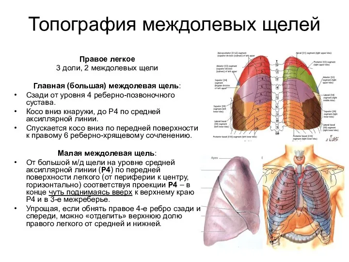 Топография междолевых щелей Правое легкое 3 доли, 2 междолевых щели