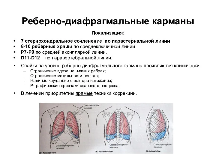 Реберно-диафрагмальные карманы Локализация: 7 стернохондральное сочленение по парастернальной линии 8-10